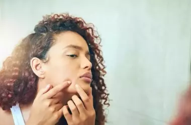 Acne sul collo: cause, rimedi e prevenzione delle imperfezioni cutanee